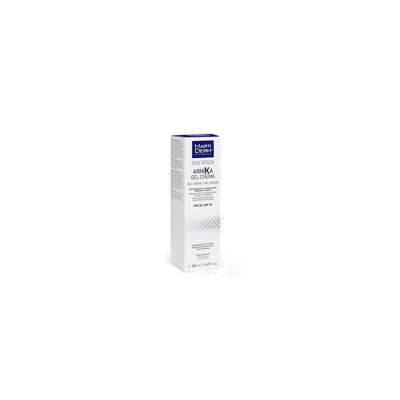 MARTIDERM ARNIKA GEL 50 ML